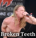 Broken Teeth photo